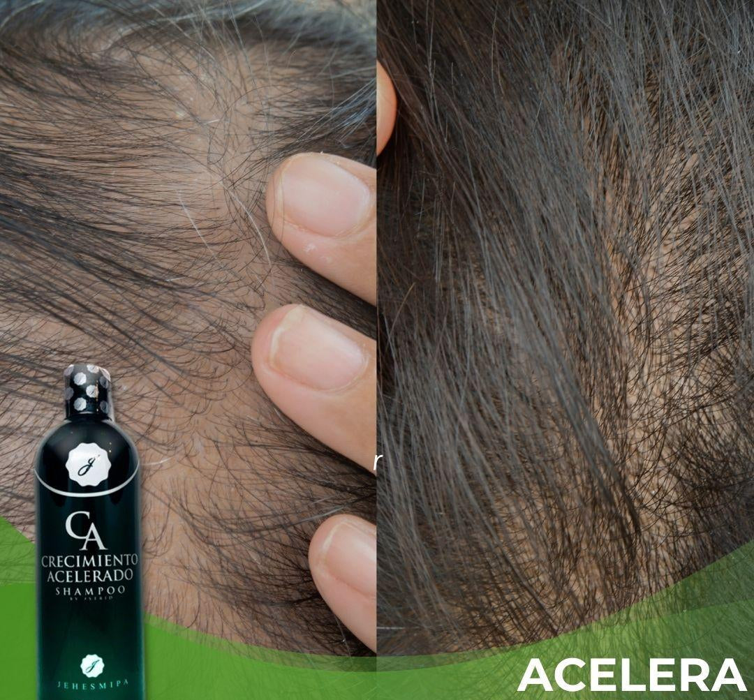 [COMPRE 1 LEVE 2] Shampoo - Crescimento Acelerado™ + Tônico capilar