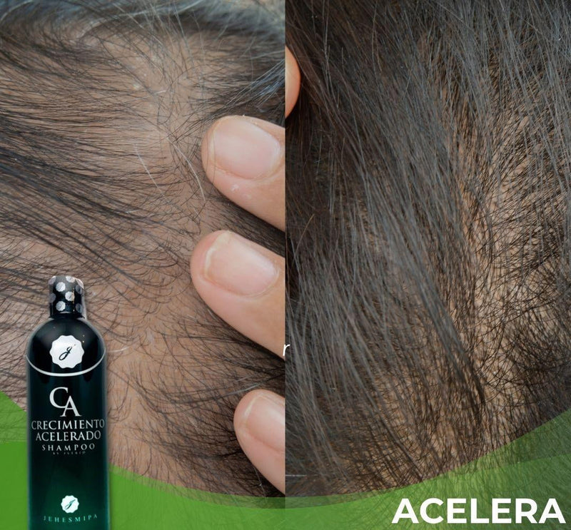 [COMPRE 1 LEVE 2] Shampoo - Crescimento Acelerado™ + Tônico capilar
